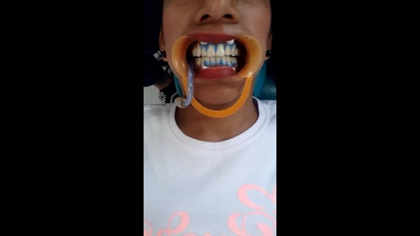 fetish- dentist
