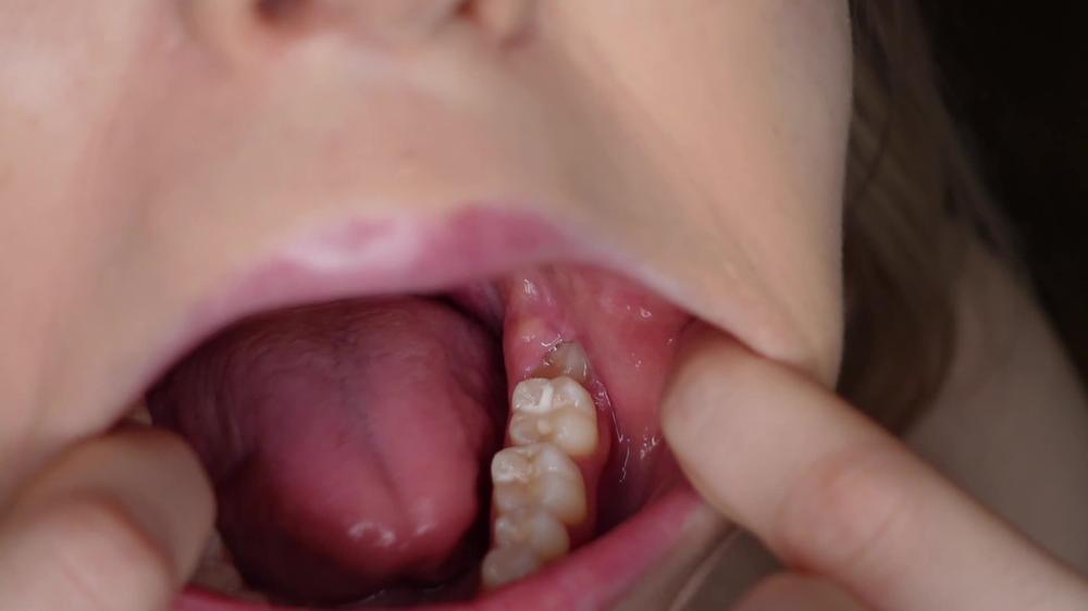 Teeth And Molars Tour Dental History