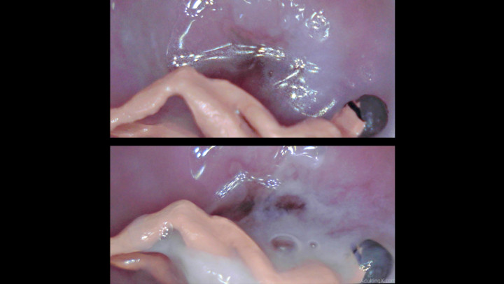 Raw: Tiny on Cervix Masturbating - Dec 11, 2021