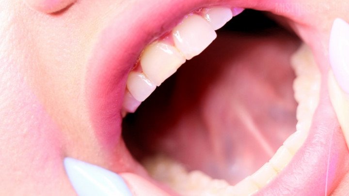 Mistressbijoux Teeth Up Close