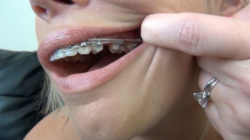 DAISY DAWSON BRACES MOUTH TOUR - October 01, 2023