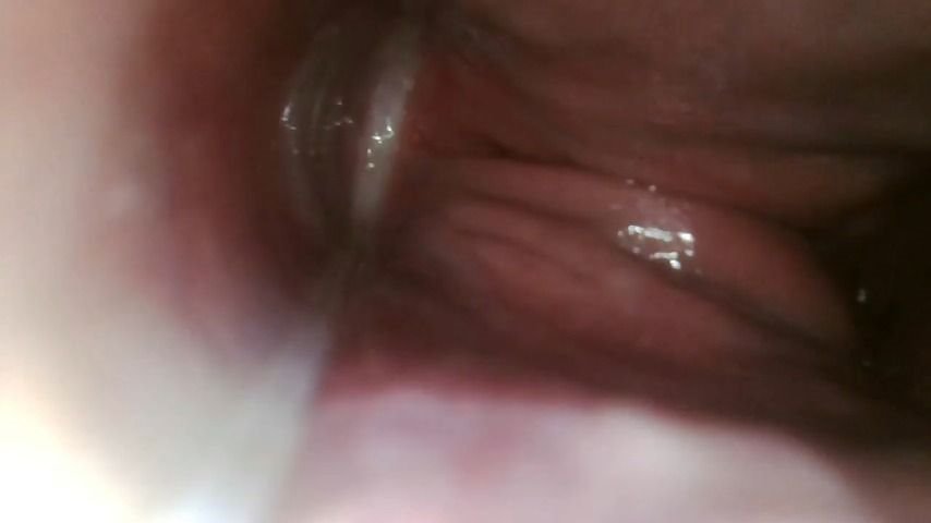 Xamy 97 Endoscope Up My Butt