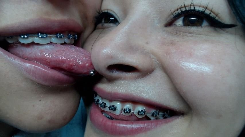 Miaisabella3 Cute Noses
