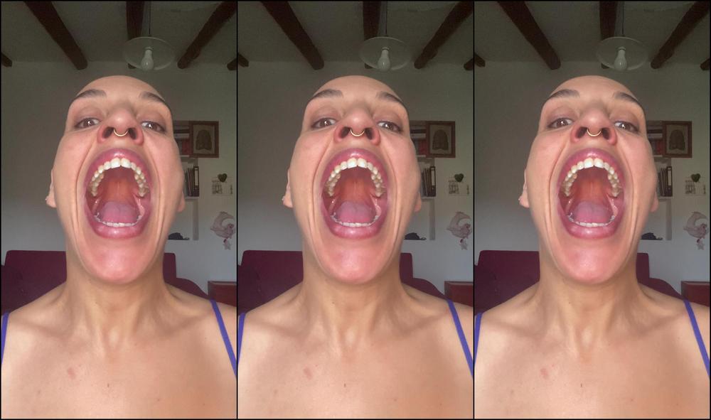 Emprexkala Teeth Tour