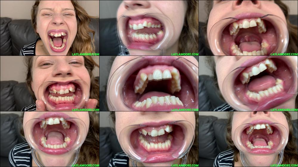 Take a Peek at Luna's Teeth