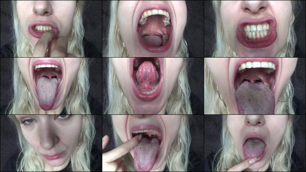Mouth Exam