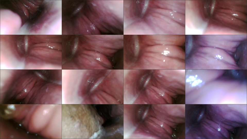 Xamy 97 Endoscope Up My Butt