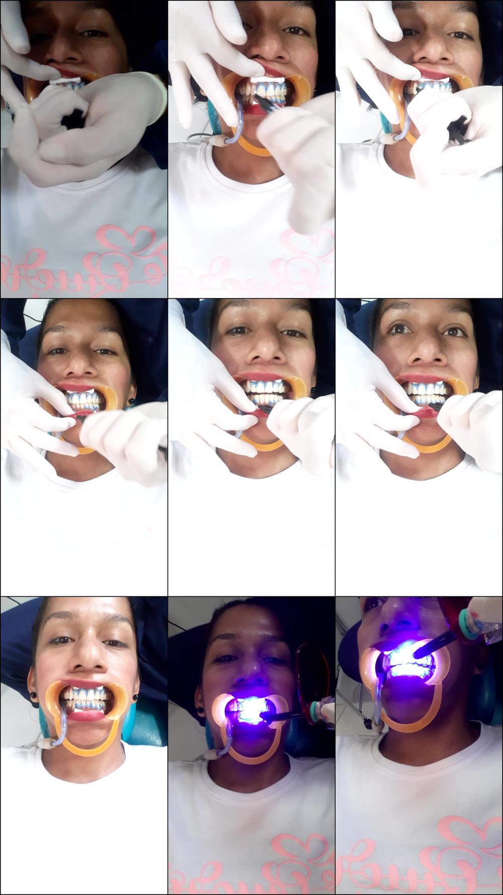 fetish- dentist