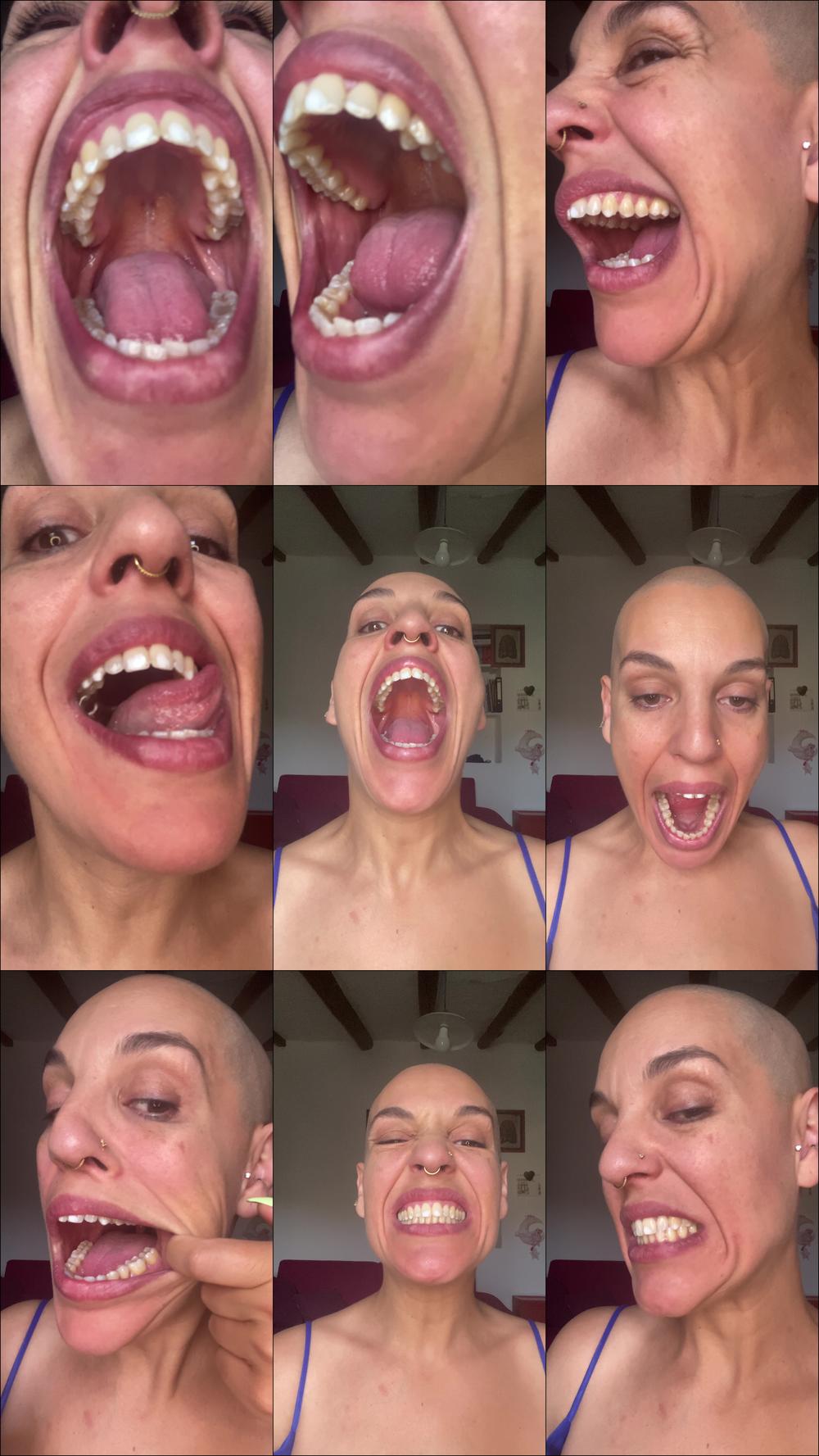 Emprexkala Teeth Tour