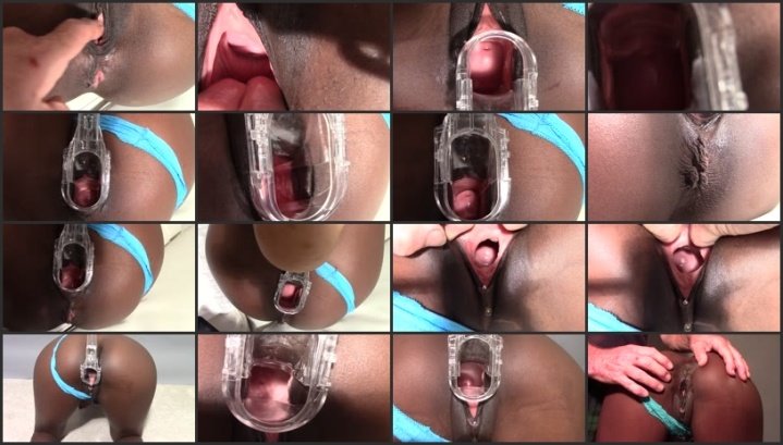 Totalpussy Pure Cervix Views