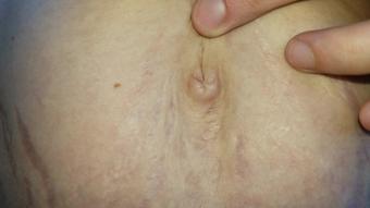 Belly Button Hiccups CUSTOM VID (Katy Faery)