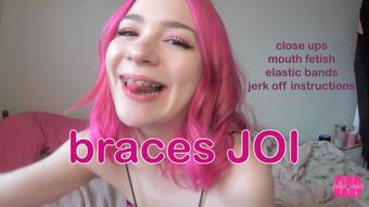 braces JOI (pinkbaby24)