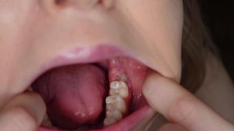 Teeth And Molars Tour Dental History (Sofie Skye)