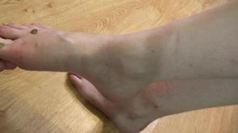 Foot Torment Girls in Poland - I Nailed 33 Thumbtacks To Her Bare Feet - Lilith (C4S Version) (Foot Torment Girls in Poland)