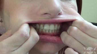 Olivia Rose Olivias Gums Lips And Teeth Custom (Olivia Rose)