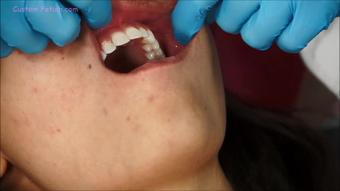 Amber's Topless Mouth Exam (Custom Fetish)