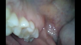 Janine & Tylee - Endoscope Mouth Tour (Ginary)