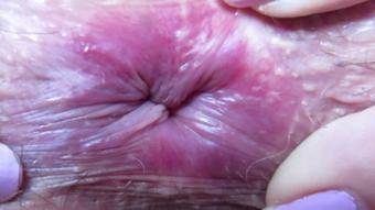 Cuteblonde666 Extreme Close Up On My Winking Asshole (cuteblonde666)
