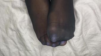 Ignoring You While Nylons Are Remove (Pink Foxx)