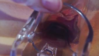 I use a Spekulum  Pussy close up (Perfekttlilly18)