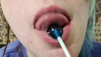 Oral Fixation With Braces Freckles (Paige Steele)