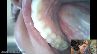 Vanessa Rain & Vika Endoscope Mouth Tour (Ginary)
