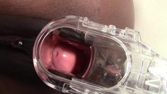 Totalpussy Pure Cervix Views (TotalPussy)