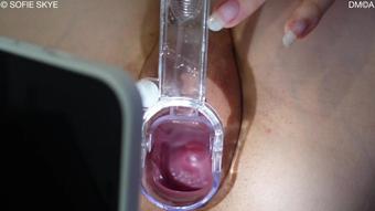 Playing Doctor With Stepbrother Speculum (Sofie Skye)
