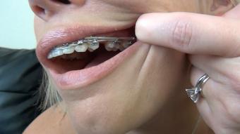DAISY DAWSON BRACES MOUTH TOUR - October 01, 2023 (RoxieRaeFetish)