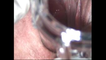 Kinkyporncpl Gyno Roleplay Speculum Inside Pussy View (KinkyPornCpl)