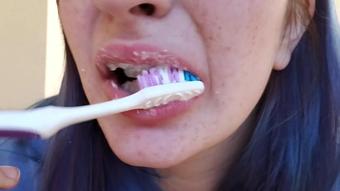 Tour Of Braces With Teeth Brushing (Paige Steele)