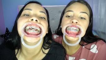 Miaisabella3 Our Mouths Braces And Tongue Tour (mia_isabella3)
