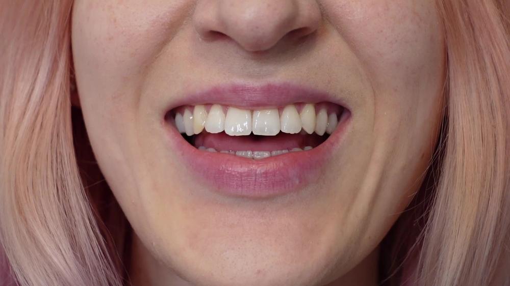 Square Lip Fetish