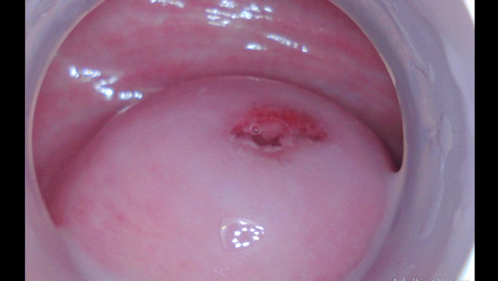 Raw: Beautiful Cervix Inside Pussy - Nov 16, 2021