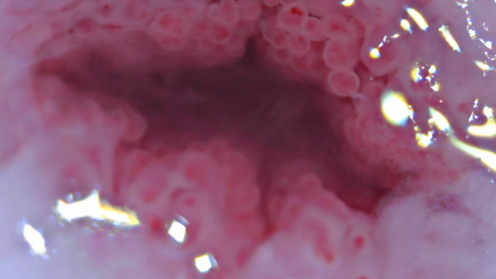Cervix Closeup Heartbeat 4K - Nov 16, 2021