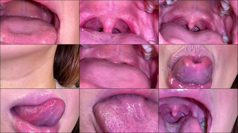 UVULA