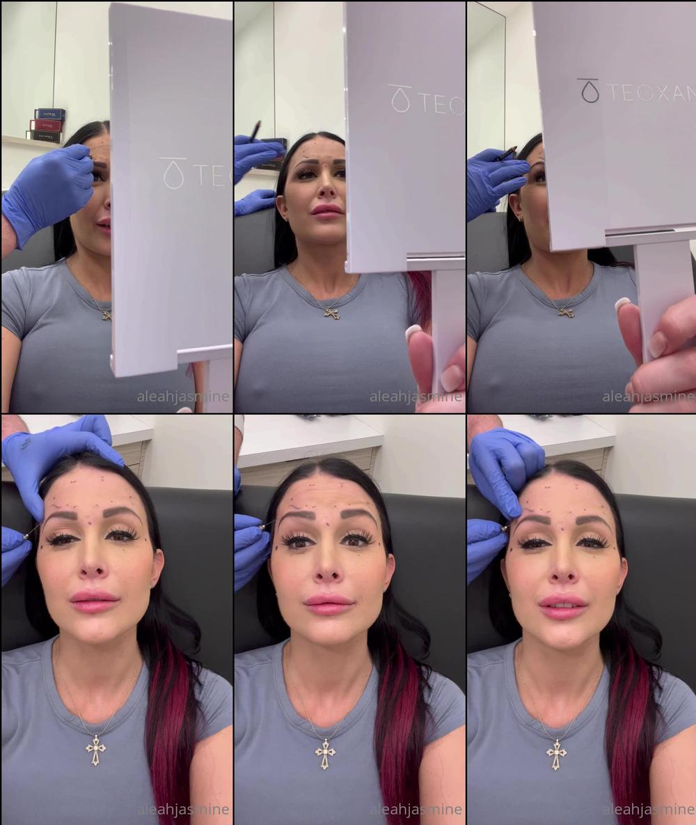 aleahjasmine 01 05 2022 2441883897 Beauty is pain lol jk im like a pro at this, done full awake surgery twice  Im steroid dep