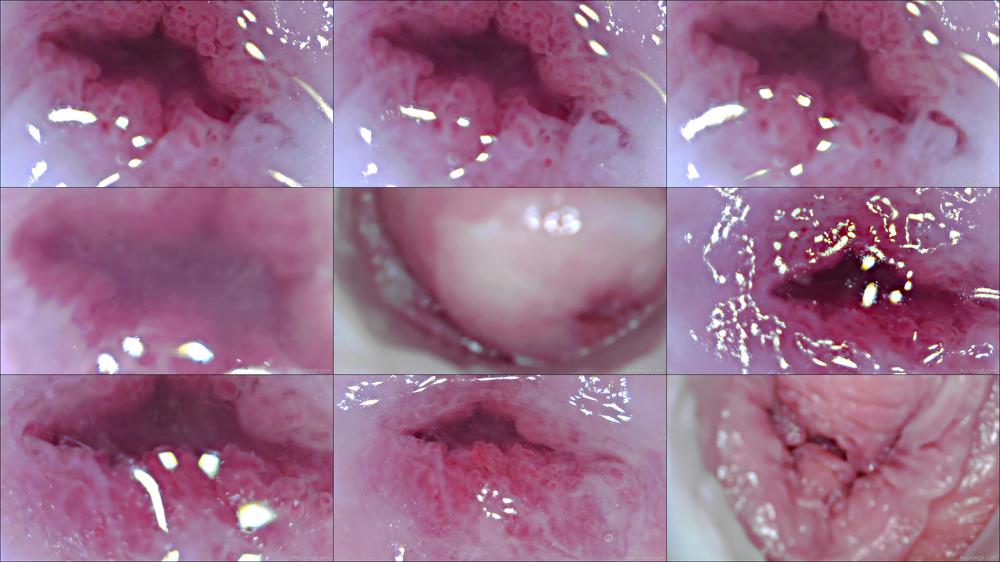 Cervix Closeup Heartbeat 4K - Nov 16, 2021