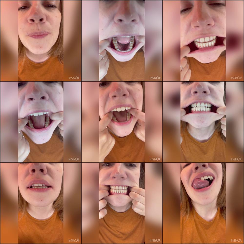 tour of my mouth - November 01, 2022