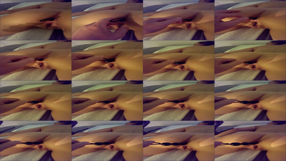 Alexapond Analbeads1