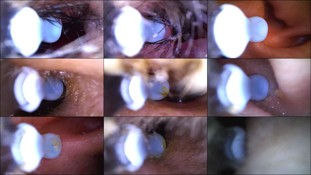 Nose and Ear Closeups