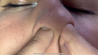 STANDARD i like to put my finger inside nostrils nose party - May 30, 2023 (Colombianbigass)