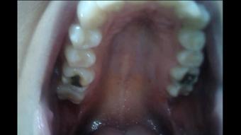 Ivy & Nikki - Endoscope Mouth Tour (Ginary)