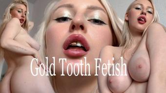 Gold Tooth Fetish (alicewarmheart)