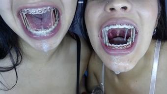 Miaisabella3 Extreme Blowjob With Braces (mia_isabella3)