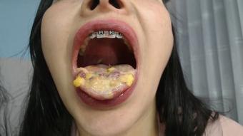Miaisabella3 Nasty Cereal Braces (mia_isabella3)