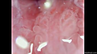 Cervical Canal 4K - Mar 15, 2022 (adulting)