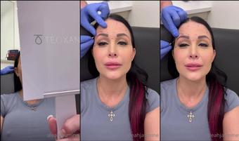 aleahjasmine 01 05 2022 2441883897 Beauty is pain lol jk im like a pro at this, done full awake surgery twice  Im steroid dep (aleahjasmine)